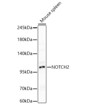 NOTCH2 Rabbit Polyclonal Antibody