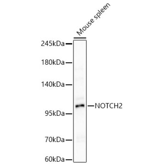 NOTCH2 Rabbit Polyclonal Antibody