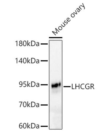 LHCGR Rabbit Polyclonal Antibody