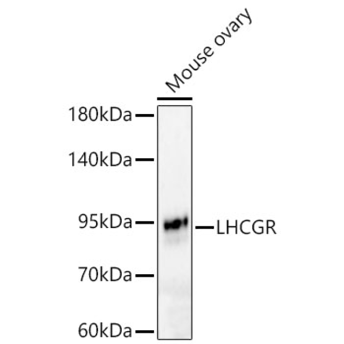 LHCGR Rabbit Polyclonal Antibody