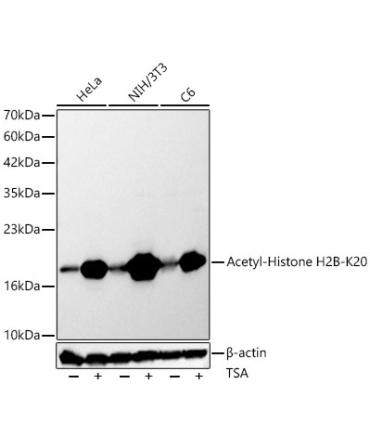 Acetyl-Histone H2B-K20 Rabbit Polyclonal Antibody