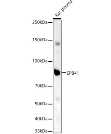 EPB41 Rabbit Polyclonal Antibody