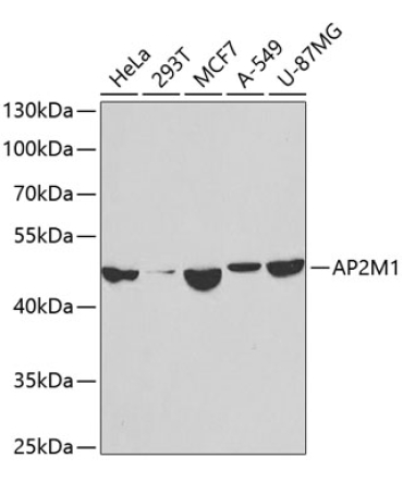AP2M1 Rabbit Polyclonal Antibody