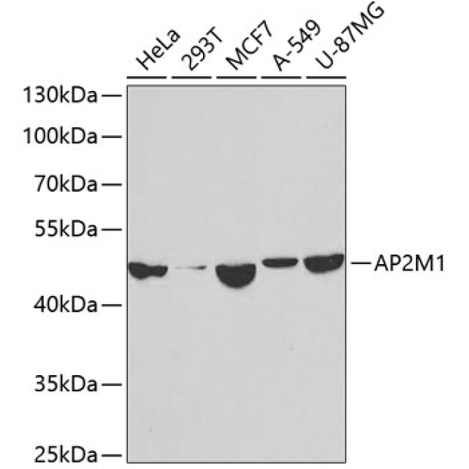 AP2M1 Rabbit Polyclonal Antibody