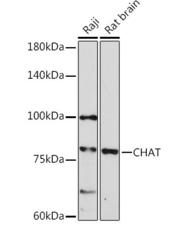 CHAT Rabbit Polyclonal Antibody