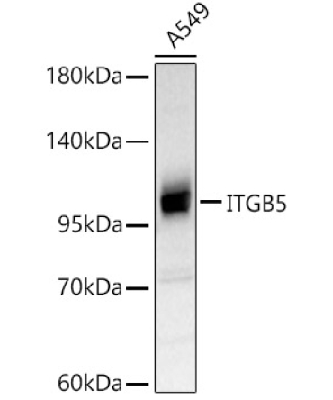 ITGB5 Rabbit Polyclonal Antibody