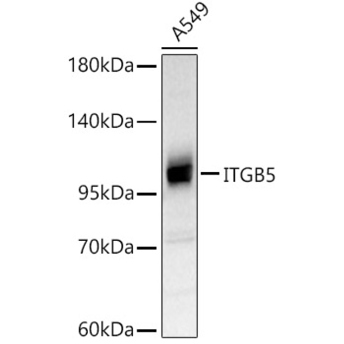 ITGB5 Rabbit Polyclonal Antibody