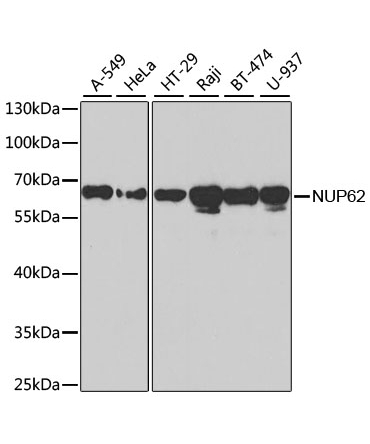 NUP62 Rabbit Polyclonal Antibody