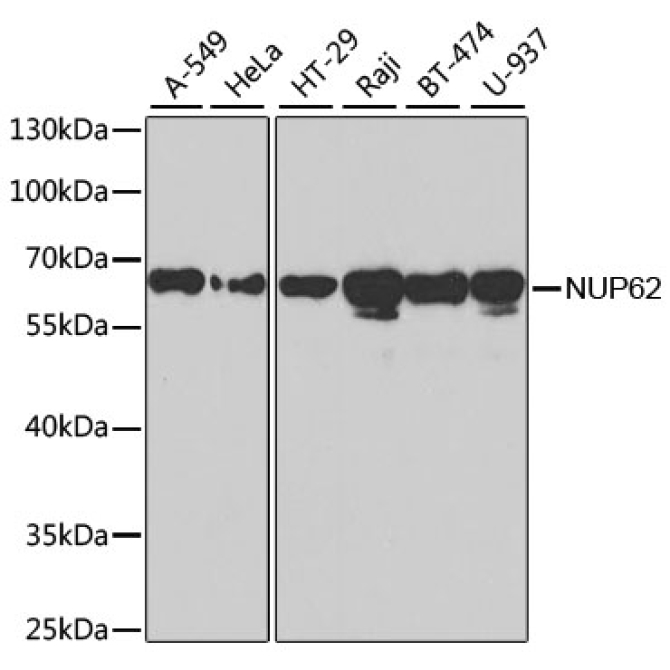 NUP62 Rabbit Polyclonal Antibody