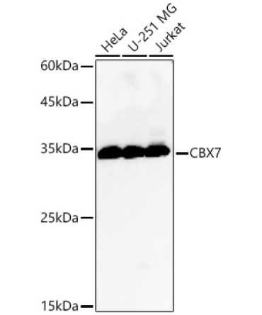CBX7 Rabbit Polyclonal Antibody