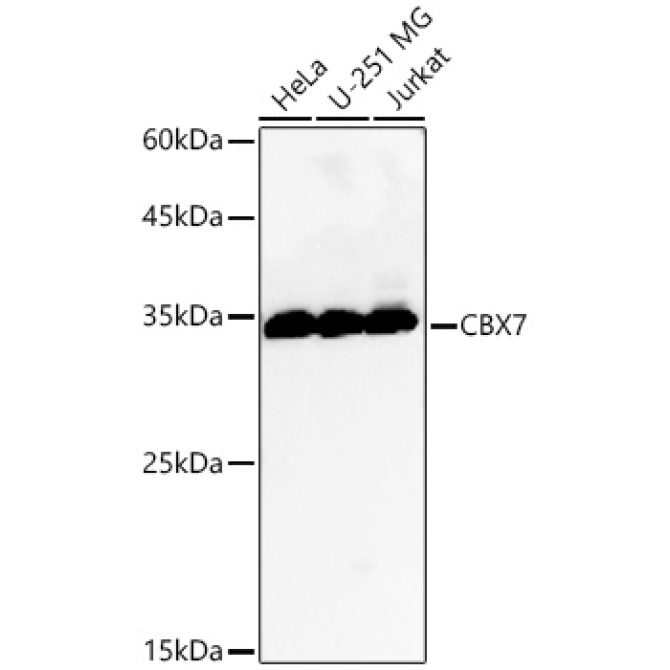 CBX7 Rabbit Polyclonal Antibody