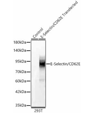 E-Selectin/CD62E Rabbit Polyclonal Antibody