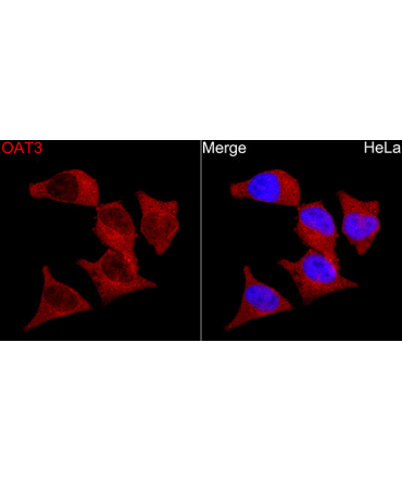 OAT3 Rabbit Polyclonal Antibody