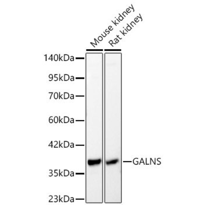 GALNS Rabbit Polyclonal Antibody