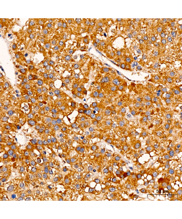 C1R Rabbit Polyclonal Antibody