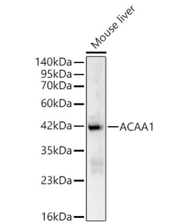 ACAA1 Rabbit Polyclonal Antibody