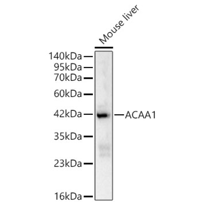 ACAA1 Rabbit Polyclonal Antibody