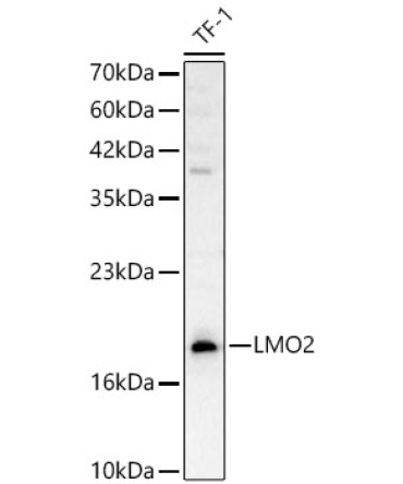 LMO2 Rabbit Polyclonal Antibody
