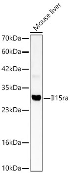 Il15ra Rabbit Polyclonal Antibody