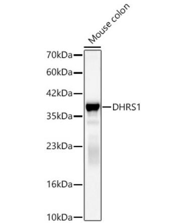DHRS1 Rabbit Polyclonal Antibody