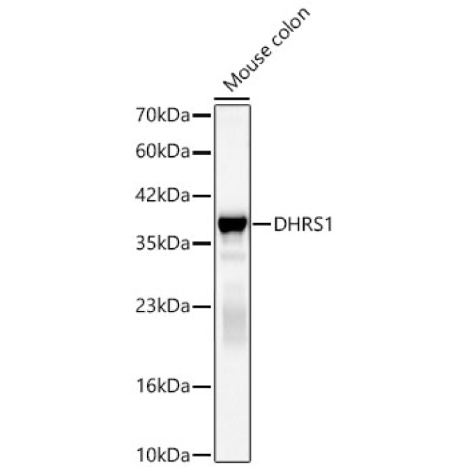 DHRS1 Rabbit Polyclonal Antibody