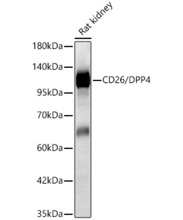 CD26/DPP4 Rabbit Polyclonal Antibody