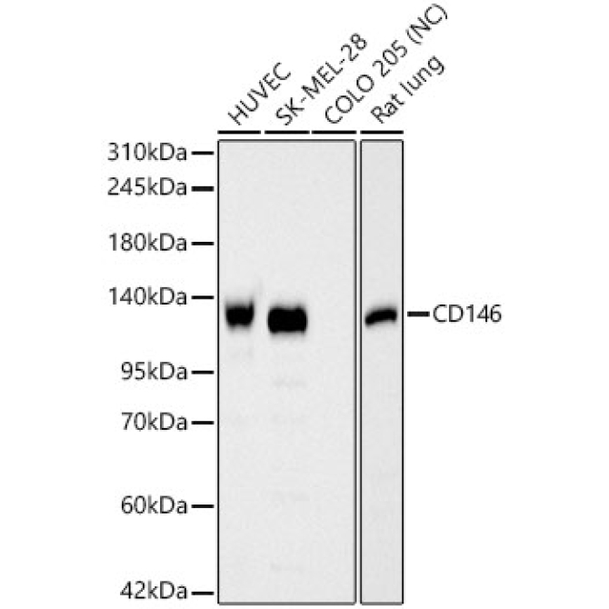 CD146 Rabbit Polyclonal Antibody