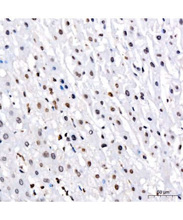 KDM7A Rabbit Polyclonal Antibody
