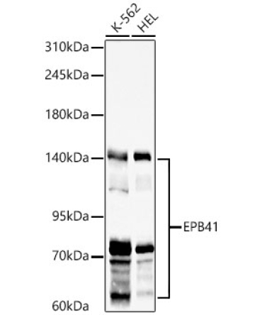 EPB41 Rabbit Polyclonal Antibody