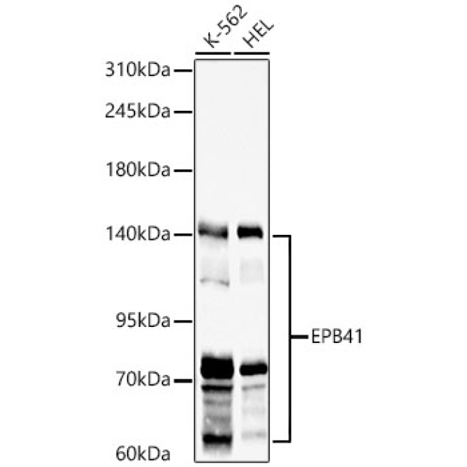 EPB41 Rabbit Polyclonal Antibody