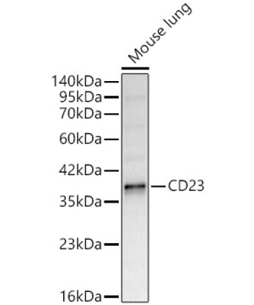 CD23 Rabbit Polyclonal Antibody