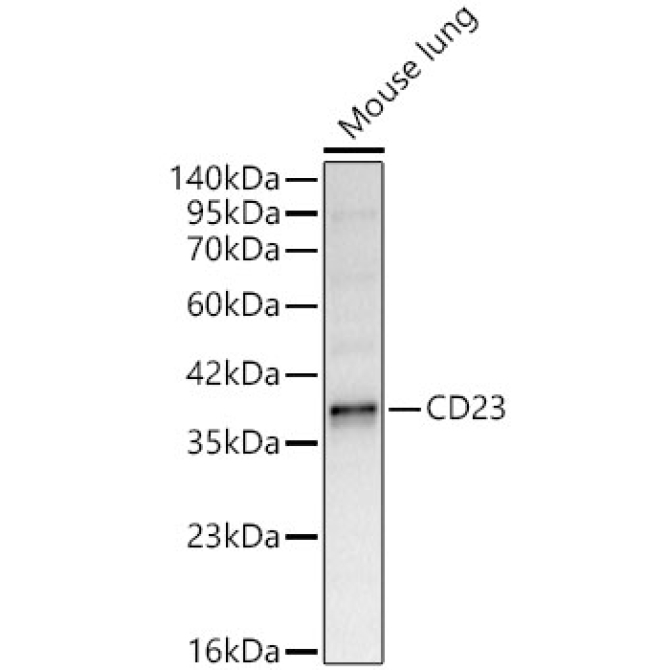 CD23 Rabbit Polyclonal Antibody