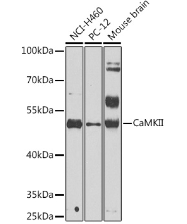 CaMKII Rabbit Polyclonal Antibody