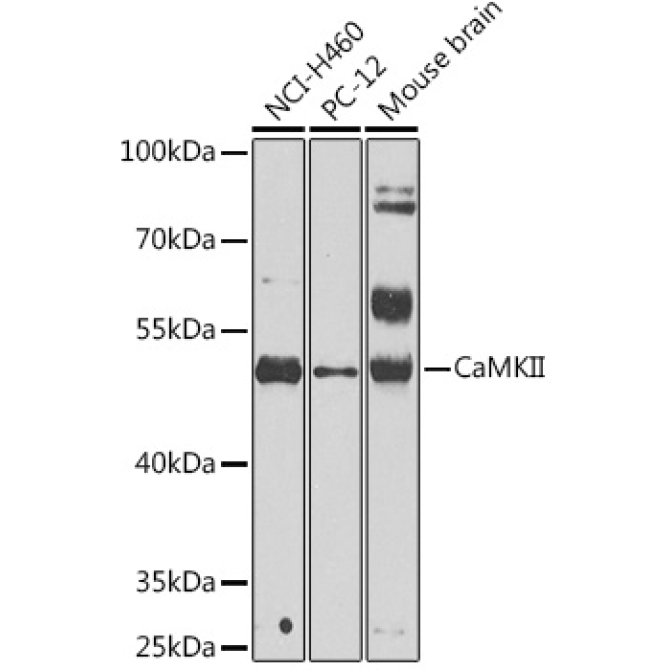 CaMKII Rabbit Polyclonal Antibody