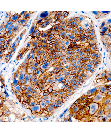DSG3/Desmoglein-3 Rabbit Polyclonal Antibody