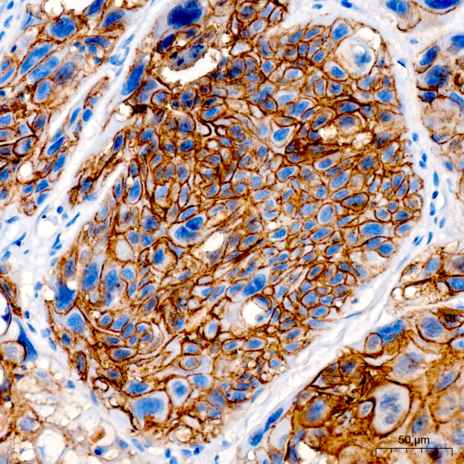 DSG3/Desmoglein-3 Rabbit Polyclonal Antibody