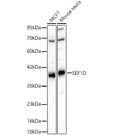 EEF1D Rabbit Polyclonal Antibody