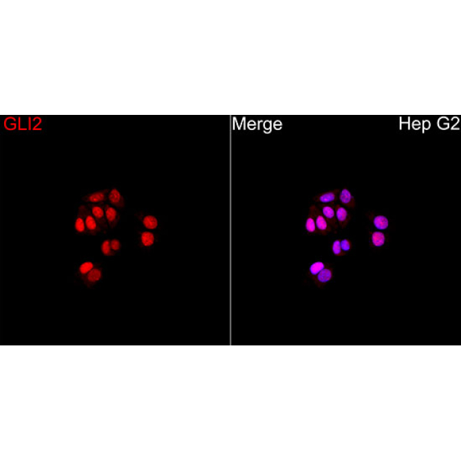 GLI2 Rabbit Polyclonal Antibody