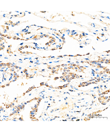 MECR Rabbit Polyclonal Antibody