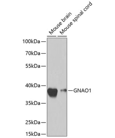GNAO1 Rabbit Polyclonal Antibody