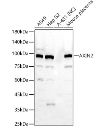 AXIN2 Rabbit Polyclonal Antibody