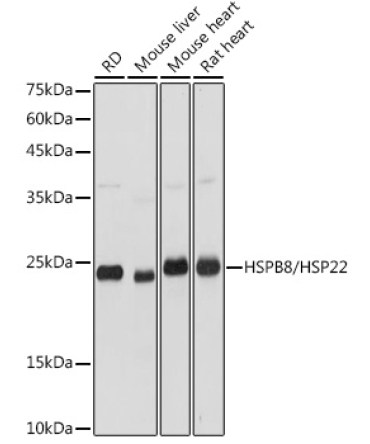 HSPB8/HSP22 Rabbit Polyclonal Antibody
