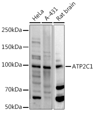 ATP2C1 Rabbit Polyclonal Antibody