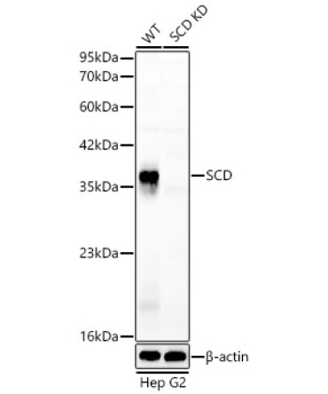 SCD Rabbit Polyclonal Antibody [KD Validated]
