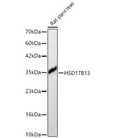 HSD17B13 Rabbit Polyclonal Antibody
