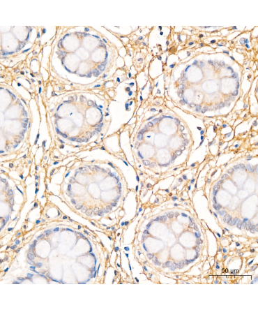 MMP2 Rabbit Polyclonal Antibody