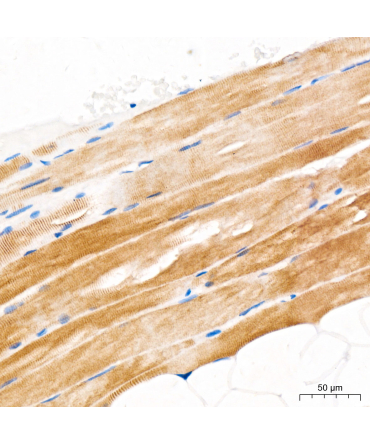 GLUT4 Rabbit Polyclonal Antibody