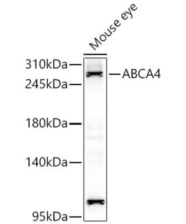 ABCA4 Rabbit Polyclonal Antibody