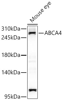 ABCA4 Rabbit Polyclonal Antibody
