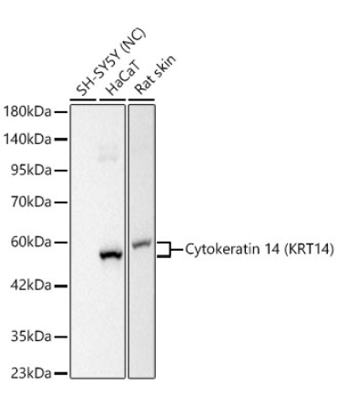 Cytokeratin 14 (KRT14) Rabbit Monoclonal Antibody